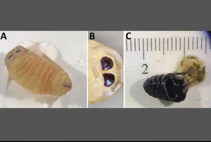 【医学前沿】人体鼻窦惊现蝇蛹：羊狂蝇跨物种寄生机理深度剖析