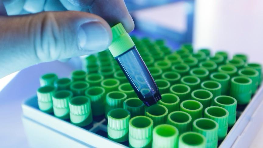  人凝血酶获批临床：派林生物子公司打开止血赛道新局面的深层逻辑 新闻